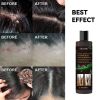 EELHOE Tinea Capitis Anti-Itch Shampoo Anti-Drop Refreshing Oil Control Hair Care Anti-Dandruff Anti-Itch Shampoo
